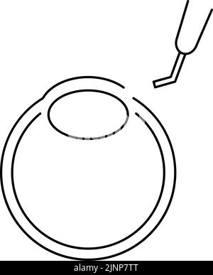 Processus de chirurgie de la cataracte, Illustration (dessin de ligne), faire une incision Illustration de Vecteur