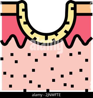 illustration vectorielle de couleur d'icône de cicatrice d'acné de roulement Illustration de Vecteur