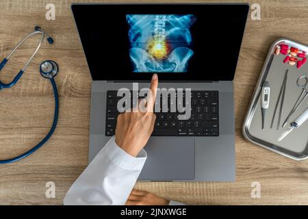 Vue de dessus du médecin montrant une radiographie de la douleur dans la colonne vertébrale. Traumatisme du mal de dos Banque D'Images