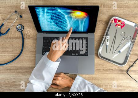 Vue de dessus du médecin montrant une radiographie de la douleur dans l'épaule sur un ordinateur portable. Banque D'Images