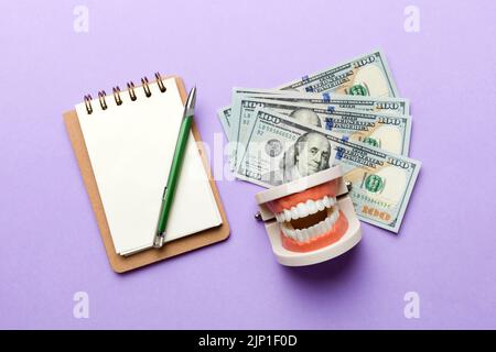 Composition de pose à plat avec modèle de typographie dentaire pédagogique et argent avec carnet sur table colorée, vue de dessus. Traitement coûteux. Banque D'Images