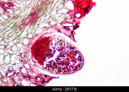 Lame de microscope Pucccinia, champignon végétal parasite. Banque D'Images