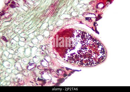 Lame de microscope Pucccinia, champignon végétal parasite. Banque D'Images