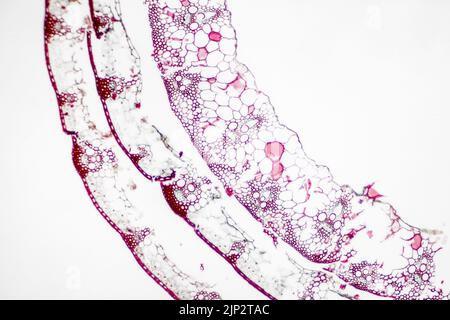 Lame de microscope Pucccinia, champignon végétal parasite. Banque D'Images