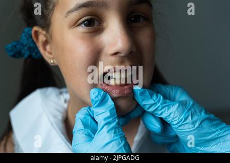 Le dentiste vérifie et définit la dimension des supports. Parler à une fille d'accolades dans sa bouche Banque D'Images