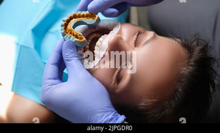 Simulation de dents artificielles sur le modèle de plâtre et patient à bouche ouverte au rendez-vous chez le dentiste Banque D'Images