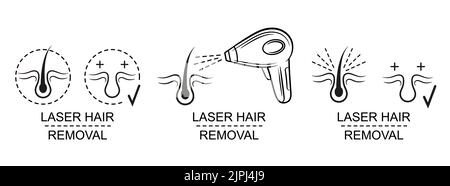 Retrait de l'ampoule laser pour cheveux, icône de la procédure d'épilation beauté pour le corps pour femme. Épilation, épilateur à lumière pulsée. Rayon de lumière de chaleur. Retirez le follicule. Vecteur Illustration de Vecteur