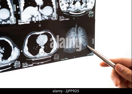 Une femme médecin examine une IRM des organes internes. Banque D'Images