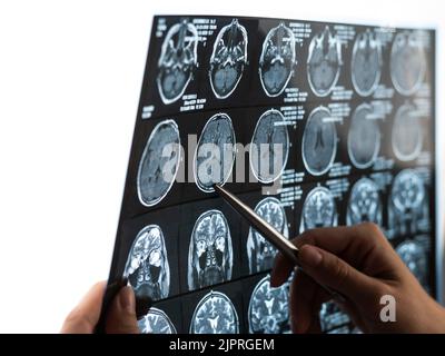 Une femme médecin examine une IRM du cerveau. Banque D'Images