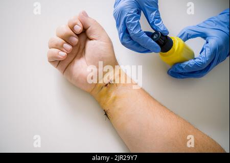 Chirurgien de culture se préparant à tendre la plaie du patient Banque D'Images