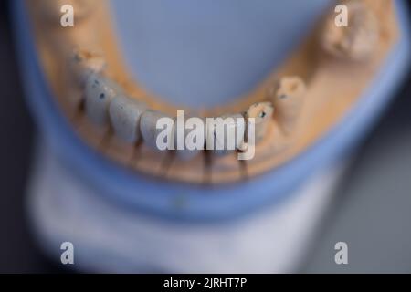 Mains de prothèses tout en travaillant sur la prothèse dentaire, les fausses dents, une étude et une table avec des outils dentaires. Banque D'Images