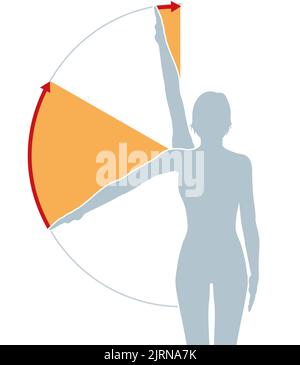 Illustration montrant le syndrome de l'impact sur l'épaule et l'arc douloureux Banque D'Images