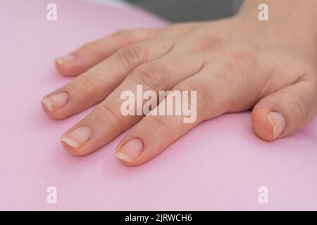 gros plan de la main d'une fille, placé sur un fond rose, la main droite de la femme avec des ongles désordonné prêt à commencer le nettoyage et la peinture dans la beauté Banque D'Images