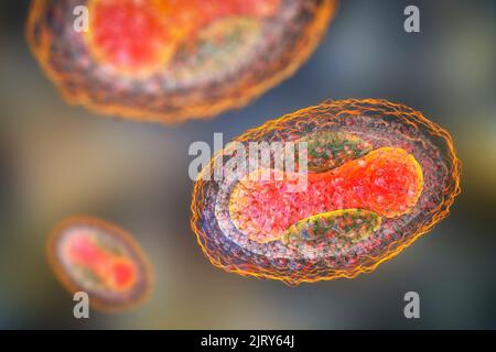 Virus de la maladie de Moluscum contagiosum, illustration Banque D'Images