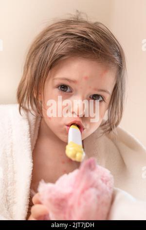 Fille drôle avec la varicelle de poulet avec thermomètre Banque D'Images