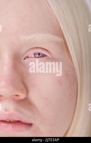 Gros plan de la jeune fille albino avec des cheveux blancs et des yeux bleus regardant l'appareil photo Banque D'Images