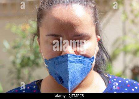 Femme avec des marques sur son visage et masque pff2 n95, protection contre le coronavirus à Rio de Janeiro Brésil. Banque D'Images