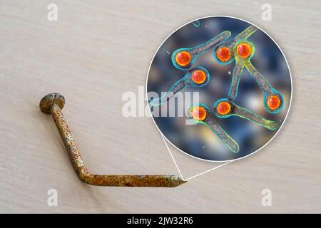 Transmission des bactéries tétaniques. Illustration conceptuelle montrant un vieil ongle en métal rouillé comme source d'infection et une vue rapprochée de la bactérie Clostridium tetani, la cause du tétanos. Banque D'Images