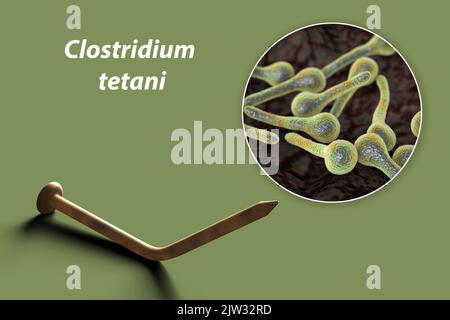 Transmission des bactéries tétaniques. Illustration conceptuelle montrant un vieil ongle en métal rouillé comme source d'infection et une vue rapprochée de la bactérie Clostridium tetani, la cause du tétanos. Banque D'Images