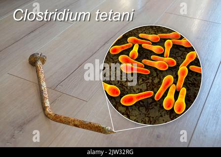 Transmission des bactéries tétaniques. Illustration conceptuelle montrant un vieil ongle en métal rouillé comme source d'infection et une vue rapprochée de la bactérie Clostridium tetani, la cause du tétanos. Banque D'Images