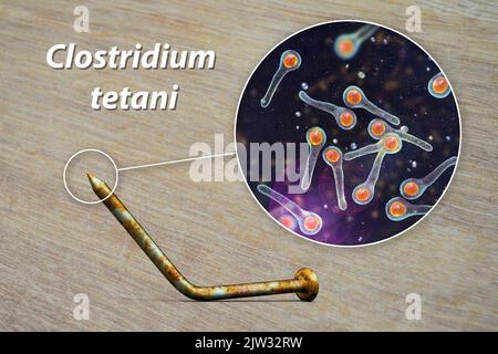 Transmission des bactéries tétaniques. Illustration conceptuelle montrant un vieil ongle en métal rouillé comme source d'infection et une vue rapprochée de la bactérie Clostridium tetani, la cause du tétanos. Banque D'Images