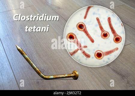 Transmission des bactéries tétaniques. Illustration conceptuelle montrant un vieil ongle en métal rouillé comme source d'infection et une vue rapprochée de la bactérie Clostridium tetani, la cause du tétanos. Banque D'Images