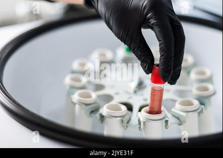 Le médecin sort un tube à essai avec du plasma sanguin de la centrifugeuse. Procédure de soulèvement du plasma pour le rajeunissement de la peau. Banque D'Images