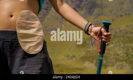 Fille avec sac de colostomie dans les montagnes. Banque D'Images