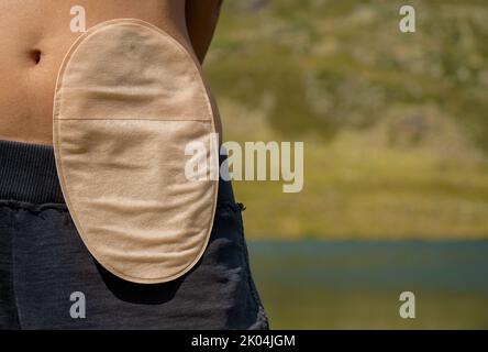 fille avec sac de colostomie dans les montagnes Banque D'Images