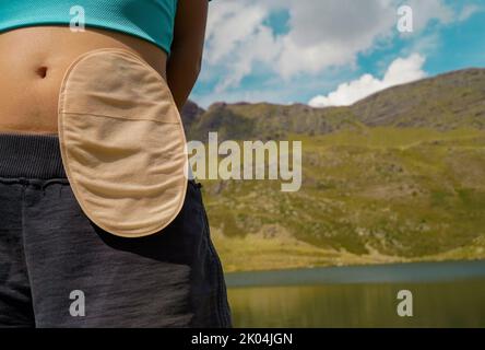 Femme avec sac de colostomie dans les montagnes. Banque D'Images