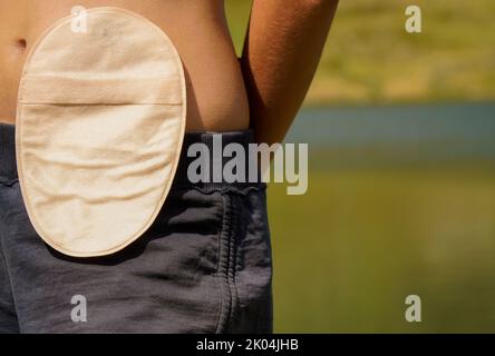 Femme avec sac de colostomie dans les montagnes. Banque D'Images