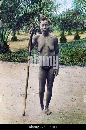 Le roi Léopold II, de l'administration belge de l'État libre du Congo, a été caractérisé par des atrocités, dont la torture et les meurtres, résultant d'une brutalité systématique notoire. Les mains d'hommes, de femmes et d'enfants ont été amputées lorsque le quota de caoutchouc n'a pas été atteint et que des millions de Congolais sont morts. Banque D'Images