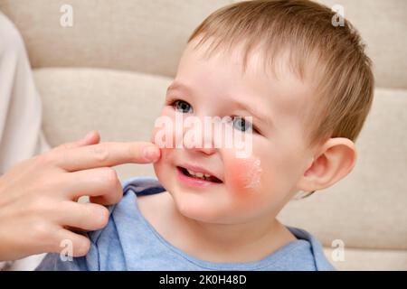 La mère sent de la crème allergique sur le visage de bébé tout-petit, le fond du canapé dans le salon à la maison. Portrait en gros plan d'un bébé mignon avec de la crème sur ses joues. K Banque D'Images