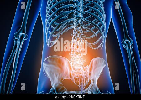 Vue postérieure ou arrière de la colonne vertébrale ou de la colonne vertébrale humaine avec inflammation ou lésion 3D illustration du rendu. Pathologie, douleur dorsale, anatomie, lumba Banque D'Images