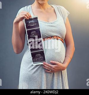 C'est les petits moments qui font la vie grande. Une femme enceinte tenant son image d'échogramme sur un fond gris. Banque D'Images