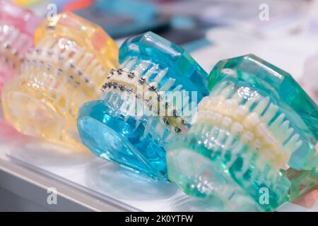 Mâchoires humaines transparentes avec bretelles orthodontiques, supports en métal et en céramique Banque D'Images