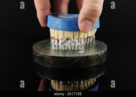 Un technicien dentaire vérifie son travail en laboratoire. Couronnes dentaires à dents créées sur une imprimante 3D pour métal Banque D'Images