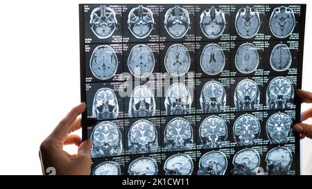 Une femme médecin examine une IRM du cerveau. Banque D'Images