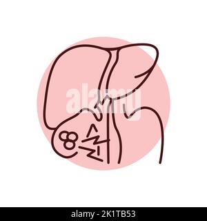 Icône de la ligne de couleur du foie de cholélithiase.Maladies humaines.Pictogramme pour page Web, application mobile, Promo. Illustration de Vecteur