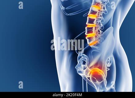 Quand l'inflammation frappe.Vue cgi d'un joint enflammé isolé en bleu. Banque D'Images