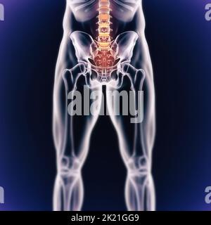 Quand l'inflammation frappe.Vue cgi d'un joint enflammé isolé en bleu. Banque D'Images