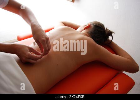 la femme se détend de la procédure d'acupuncture. Une acupuncture acupuncturiste doong très précisément. Médecine chinoise traditionnelle Banque D'Images