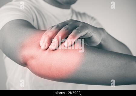 Blessure au coude due au tennis et au golf. L'homme utilise les doigts pour masser son bras. La zone des symptômes de douleur est indiquée en rouge. Connaissance des soins de santé. Gros plan moyen avec espace de copie. Ton noir et blanc. Banque D'Images