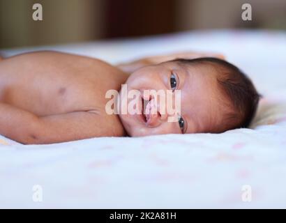 Elle ne laisse pas son défaut de naissance la réduire. Portrait d'une petite fille avec une fente palatine sur un lit. Banque D'Images