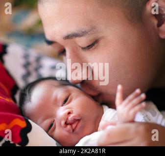 Le baiser affectueux d'un père. Photo d'un jeune père donnant à sa petite fille qui a une fente palatine un baiser sur la joue. Banque D'Images