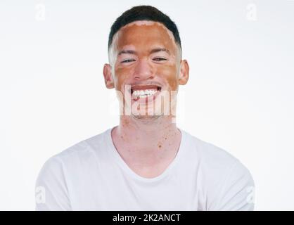 Ce qui vous rend différent vous rend magnifique. Portrait d'un beau jeune homme avec le vitiligo posé sur un fond blanc. Banque D'Images