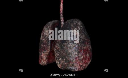 Poumons humains du fumeur Banque D'Images