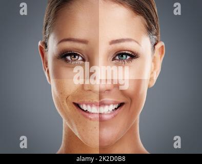 La diversité est belle. Photo composite d'un visage de femme composé de différentes skintones. Banque D'Images