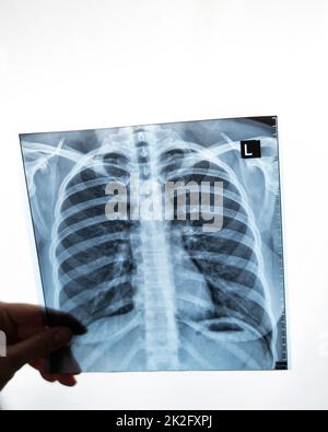 Médecin montrant une radiographie des poumons du patient. Banque D'Images