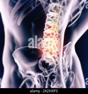 Quand l'inflammation frappe.Vue cgi d'un joint enflammé isolé en bleu. Banque D'Images